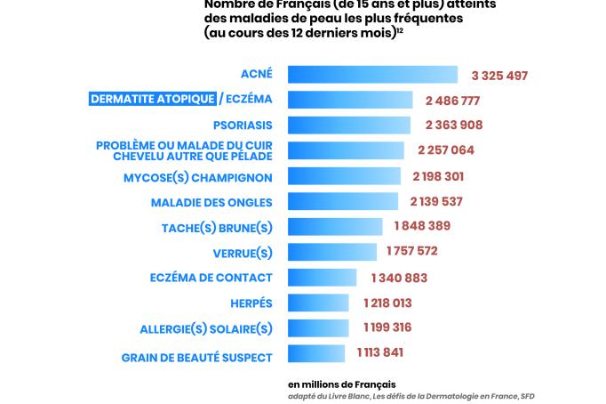 classement des maladies de peau