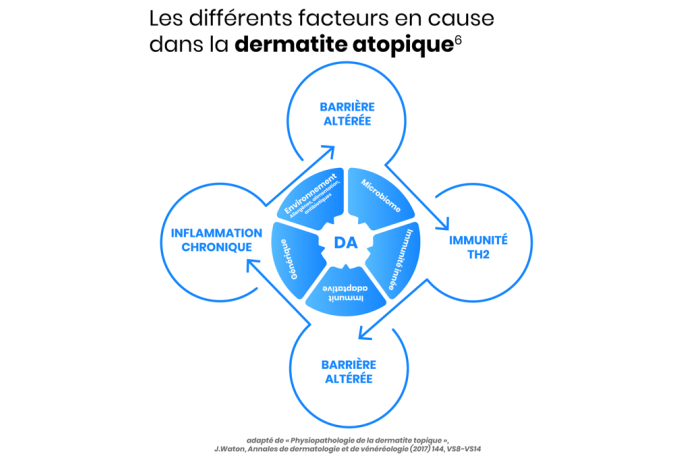 Les differents facteurs en cause dans la DA